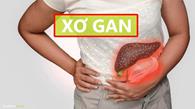 ALO BACSI | MẸ EM BỊ XƠ GAN F1 CÓ DÙNG ĐƯỢC YẾN SÀO?